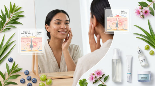 Acne skincare routine featuring salicylic acid, tea tree oil, gentle cleansing, moisturising and botanical ingredients for clearer, healthier-looking skin.